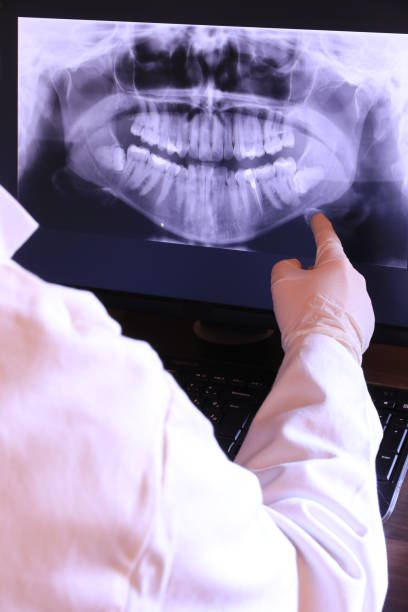 Best Emergency Tooth Extraction in Kenedy, TX
